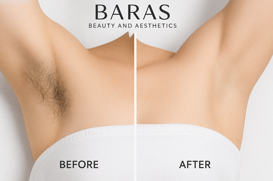 Laser Hair Removal: Everything You Need to Know